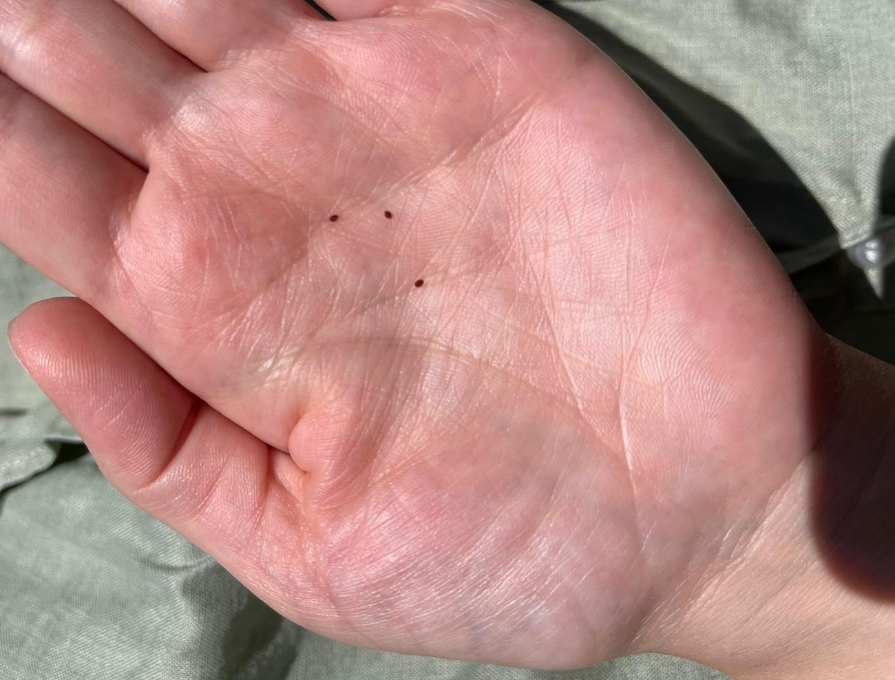 How to Treat Bird Mites on Humans